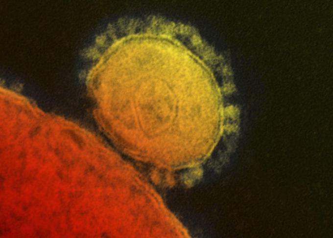 V različnih državah sveta so pri človeku že zabeležili okužbo z bližnjevzhodnim respiratornim sindromom (Mers). | Foto: Reuters