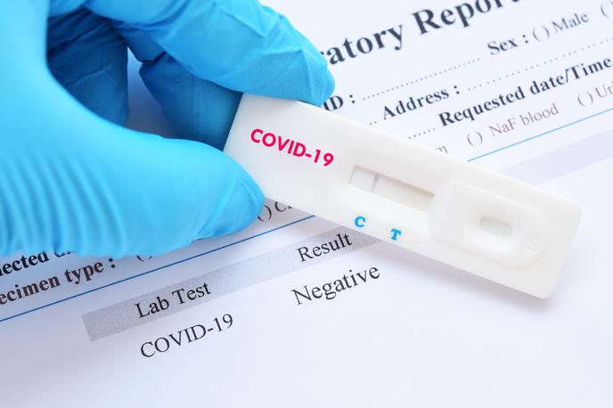 Koronavirus. Cepljenje. Test. Testiranje covid-19. Covid-19 | Foto Shutterstock