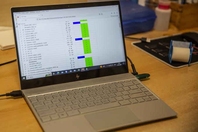 Računalniški program, ki ga uporablja Planet zdravja, na osnovi telesne temperature izračuna 150 različnih krvnih parametrov.  | Foto: Ana Kovač