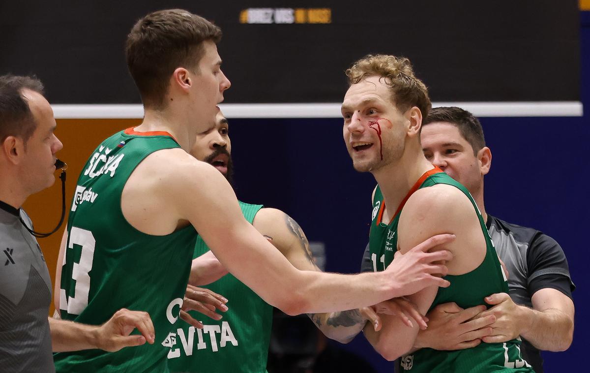 Jaka Blažič Cedevita Olimpija | Jaka Blažič je ob bližnjem srečanju z Mahkovicem zakrvavel pod očesom. | Foto Filip Barbalić/www.alesfevzer.com