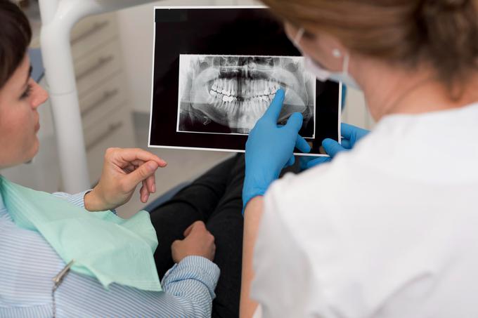 HappyMed ima ugledne in vrhunske specialiste dentalne medicine in zobozdravnike na Hrvaškem. Med njimi so redni in izredni profesorji ter znanstveni sodelavci na Stomatološki fakulteti Univerze v Zagrebu. Zobozdravstvene storitve potekajo v zasebnih ordinacijah ter na klinikah in se izvajajo z metodami, ki so trenutni vrhunski dosežki znanosti in tehnologije. Pri pacientih, ki imajo močan refleks na bruhanje, se uporablja sedacija. | Foto: HappyMed