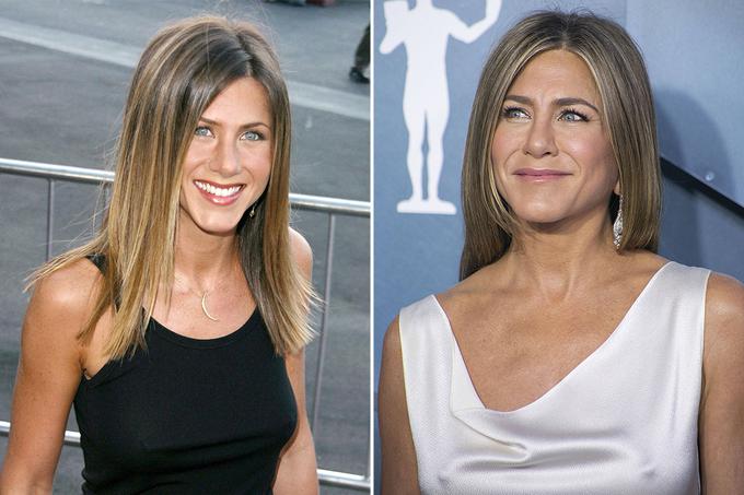 Jennifer Aniston B&A | Foto: 