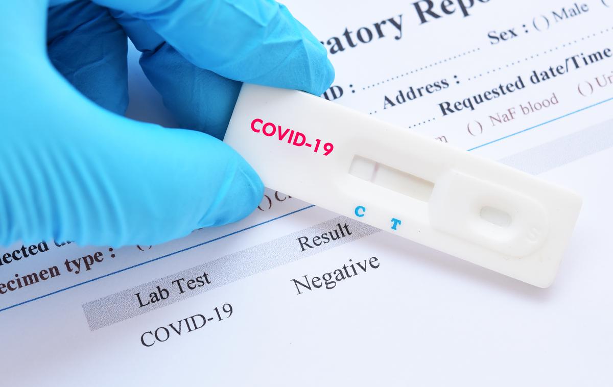 Koronavirus. Cepljenje. Test. Testiranje covid-19. Covid-19 | Vlada je 5. novembra lani ceno storitve hitrega testiranja omejila na sedem evrov, ceno testov za samotestiranje pa na 2,50 evra na test brez DDV.  | Foto Shutterstock