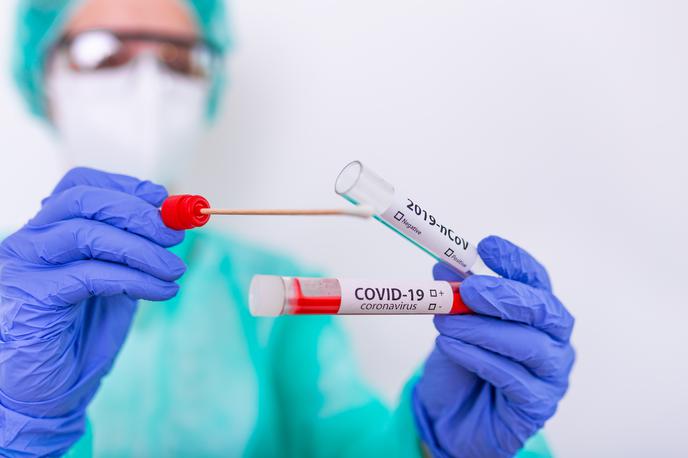 Koronavirus, Korona. Covid. Covid-19. Cepjenje. Test. Testiranje. Maske. | Foto Shutterstock