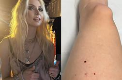 Ameriško pevko Taylor Momsen med koncertom ugriznil netopir #video