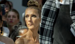 Celine Dion izgubila nadzor nad mišicami