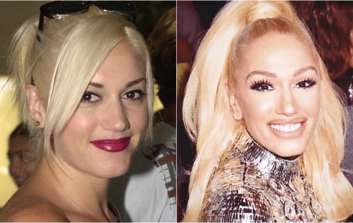 Gwen Stefani 2001 2019 | Gwen Stefani leta 2001 in danes | Foto Getty Images / Instagram