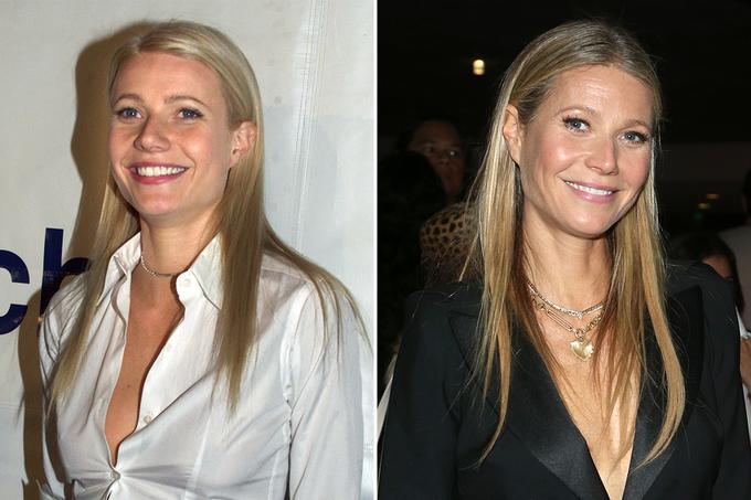 Gwyneth Paltrow B&A | Foto: Cover Images