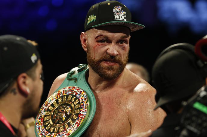 Tyson Fury | Tyson Fury je odločen. | Foto Reuters