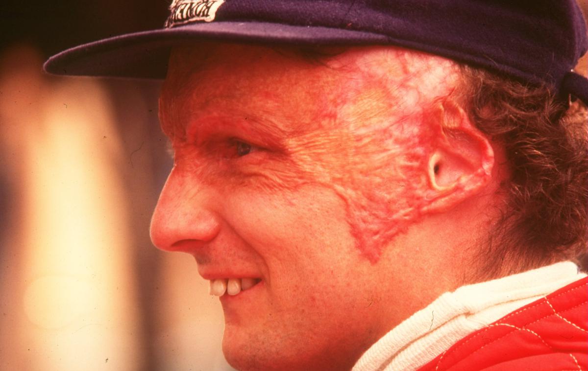 Niki Lauda 1976 | Foto Guliver/Getty Images