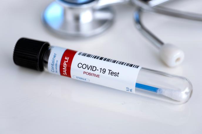 Covid. Koronavirus. Testiranje. Korona. Covid-19 | Foto Shutterstock