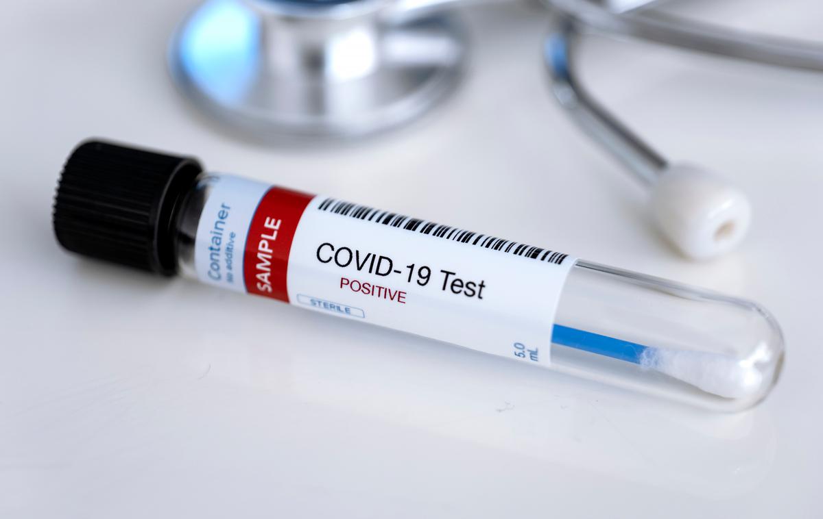 Covid. Koronavirus. Testiranje. Korona. Covid-19 | Primerjava s prejšnjim četrtkom kaže, da so včeraj v državi potrdili 407 okužb manj.   | Foto Shutterstock