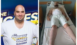 Aleš Hrvatin prestal operacijo odstranitve odvečne kože #foto