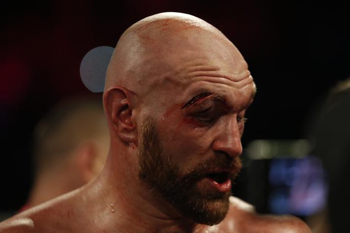 Tyson Fury | Tyson Fury je takoj po dvoboju odšel v bolnišnico. | Foto Reuters