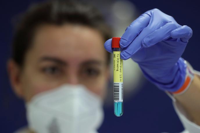 koronavirus covid test | Veliko držav za prestop svoje meje zahteva sveže opravljen test na novi koronavirus z negativnim rezultatom. | Foto Reuters