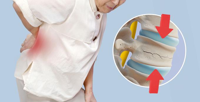 medicofit | Foto: Shutterstock/Medicofit